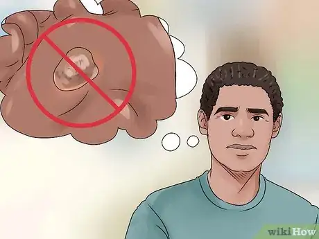 以Treat a Corn or Callus Step 15为标题的图片